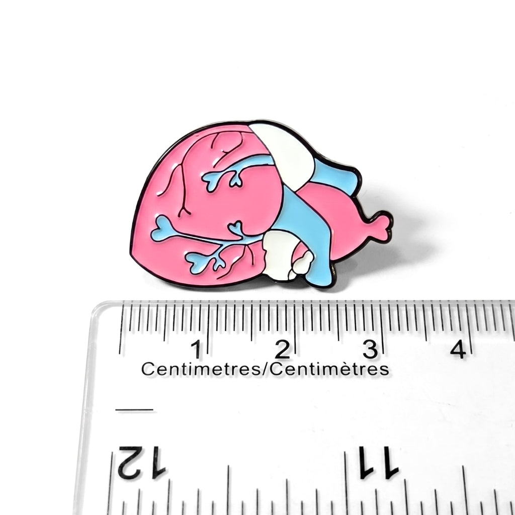 Trans-planted Heart [Pride] | Collectible Pin